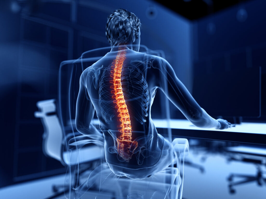 3D-Darstellung eines Mannes, der an einem PC arbeitet und Rückenschmerzen hat